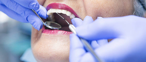 Best Emergency Wisdom Teeth Removal in Machesney Park, IL