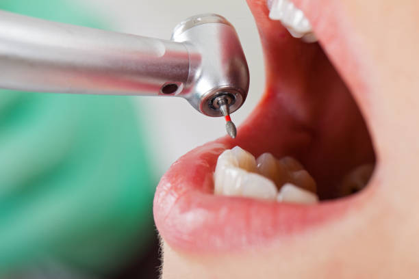 Best Emergency Treatment for Dental Infections or Abscesses in Machesney Park, IL